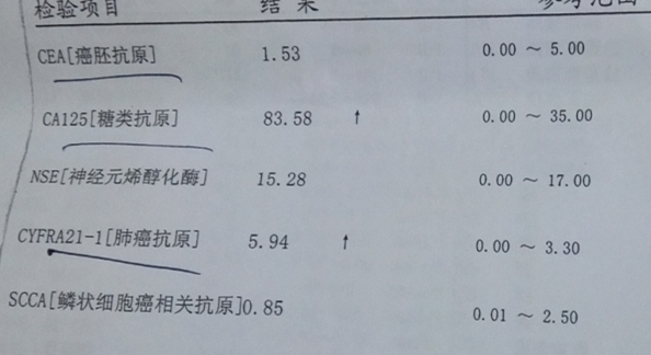 15年12月2日肿瘤标志物检查报告