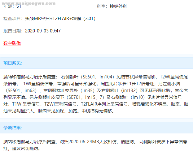 脑部核磁报告