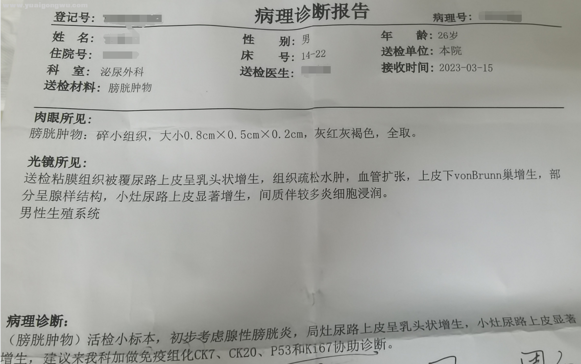 第一次膀胱镜检查取活检病理结果